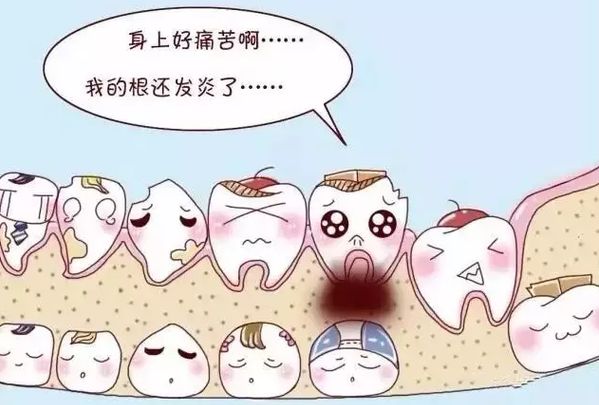 绍兴蛀牙以后补可以吗拖久了有什么后果?